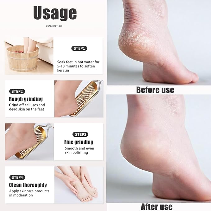White Foot File Callus Remover, Foot File for Feet – Professional Pedicure Tool for Dead Skin Removal & Cracked Heels – Ultimate Stainless Steel Foot Scrubber for Soft, Healthy Feet