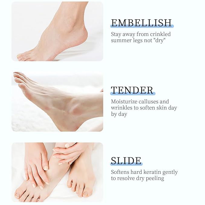 O'CHEAL Anti-Drying Crack Foot Cream Hand Cracked Repair Cream Body Cream Cracked Feet Removal Dead Skin Hand Feet Care Skin