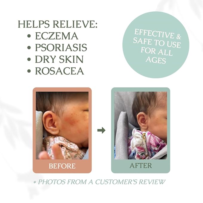 Hearth and Homestead: Handmade Whipped Tallow Balm, Organic, Moisturizer, Body Butter with Infused Olive Oil, for Eczema, Rosacea, Baby (Lavender)