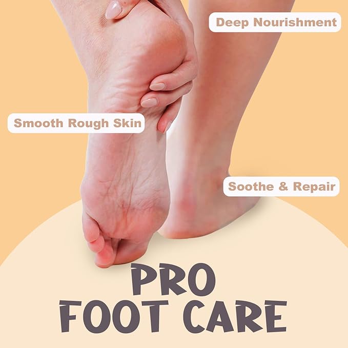 Urea Cream 40 Percent for Dry, Cracked Heels and Feet with Coconut Oil & Vanilla Planifolia, Callus Remover and Skin Softener, Maximum Strength Foot & Hand Cream – 1.41 oz