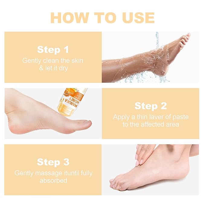 60% Urea Cream - 1.41 oz Manuka Honey Foot Hand Cream Stick for Dry & Cracked Feet Elbows Knees Heels Hands, Hydrates & Nourish Foot Care for Softening and Moisturizing, Removing Calloused Skin