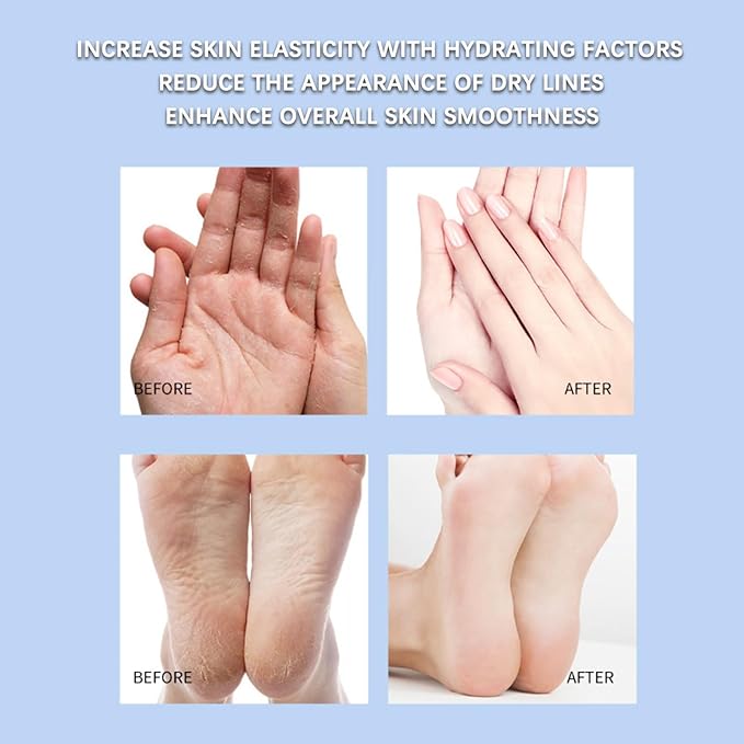 Vovo Angel Winter Foot Care Cream with Aloe Vera & Urea – Deep Moisturizing Heel Repair Balm for Dry, Cracked Feet, Softening & Nourishing Foot Moisturizer, 40g (Aloe Vera, 40g)