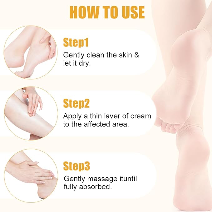 2Pcs 60% Urea Foot Cream Set, Hydrating Cracked Heel Stick Balm, Formulated with Pure Aloe Vera, Salicylic Acid, Avocado Oil, Repair Balm for Cracked Hands, Elbows, Knees, Feet & Heels