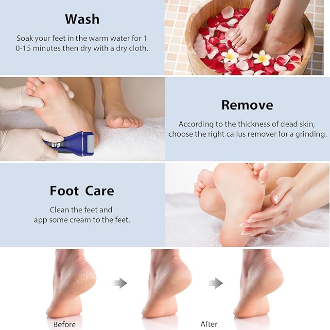 Electric Callus Remover for Feet, Rechargeable Portable Electronic Foot Callus Remover 2-in-1 Wet/Dry Foot Scrubber Electric Toot File for Hard Cracked Dry Dead Skin(Blue)