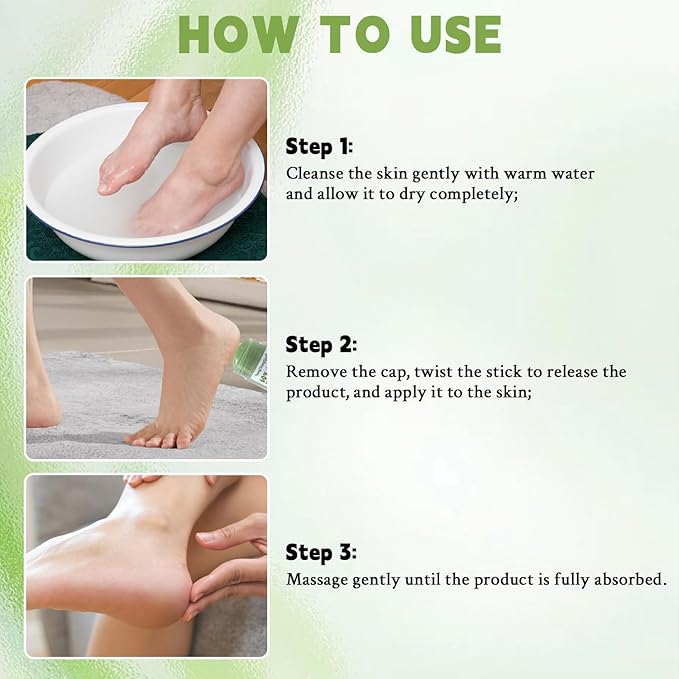 60% Urea with 2% Salicylic Acid Foot Hand Care Stick with Aloe Vera & Tea Tree - Urea Cream for Dry Cracked Feet Hands Heels Elbows Knees, Provides Deep Hydration and Softens Dead Skin, 1.41 oz