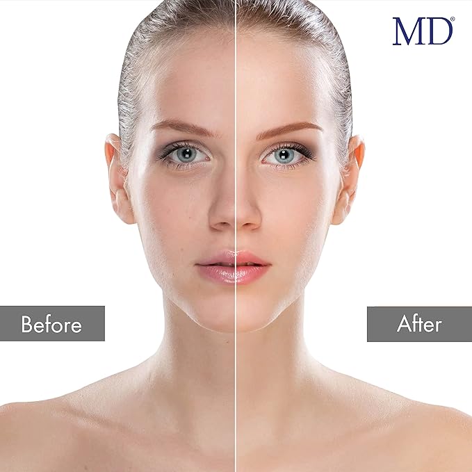 MD® Enzyme Peeling Mask – 30 mL | Gentle Exfoliating Gel with Natural Papaya & Pineapple Enzymes