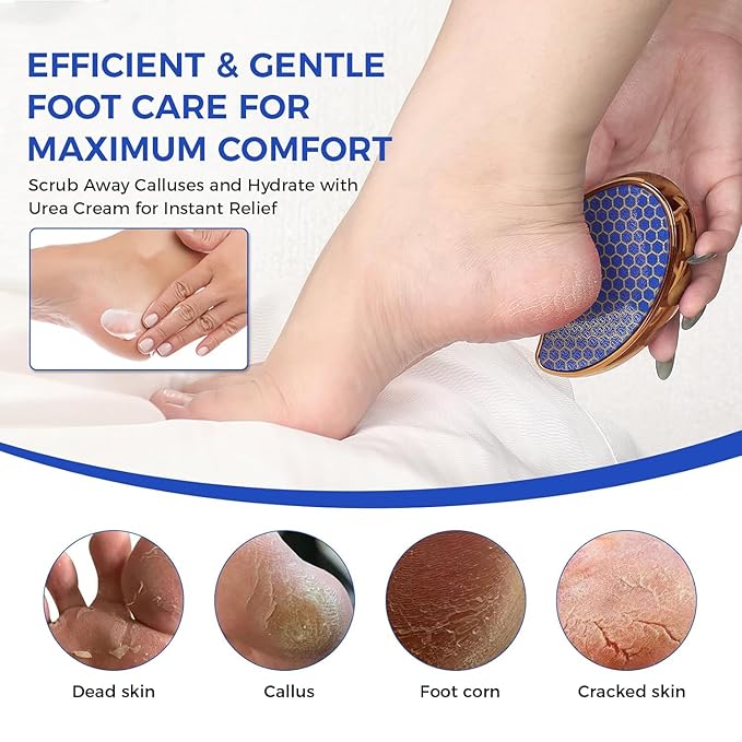 OUKEYA Urea Cream 40 Percent for Foot & Hand Cream with Foot Files for Dry Cracked,Urea Lotion for Feet Maximum Strength