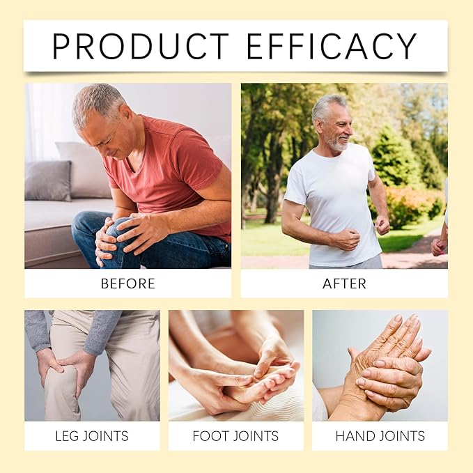 Bee Venom Joint Gel, Professional Bee Venom Ointment,Bee Venom Cream,Bee Venom Joint and Bone Cream for Back, Knee, Hands, Neck, Feet -60g (2PCS)