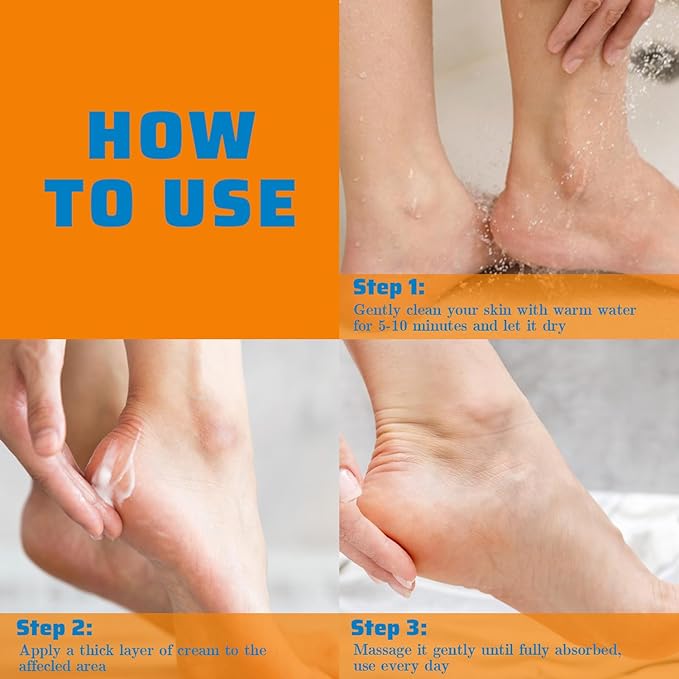 Urea Cream 60 percent for Feet Maximum Strength with 2% Salicylic Acid for Dry Cracked, Soothes and Softens Foot Hands Elbows Knees Heels, Remove Calluses Deep Moistrizing with Aloe Vera, 8.8 oz