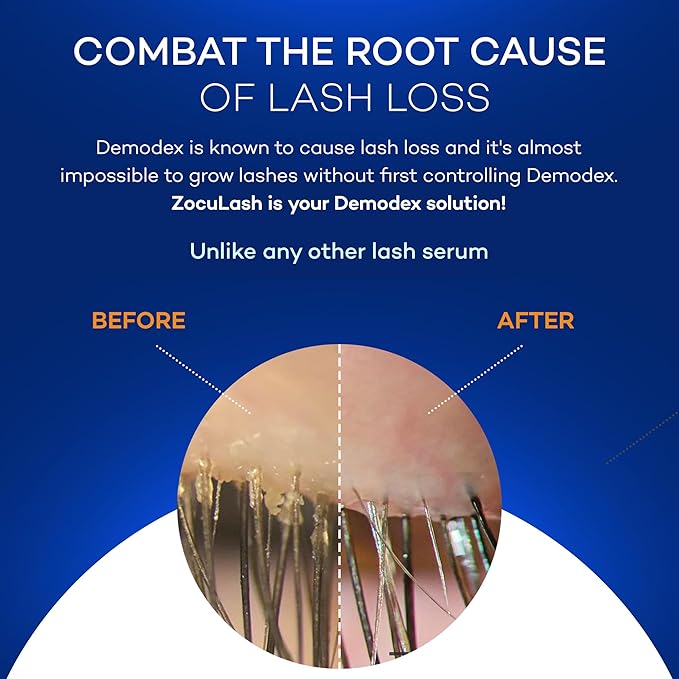 Zocular ZocuLash Eyelash Serum - Safe, Effective Eyelash Growth Serum for Daily Use - 2.5 mL