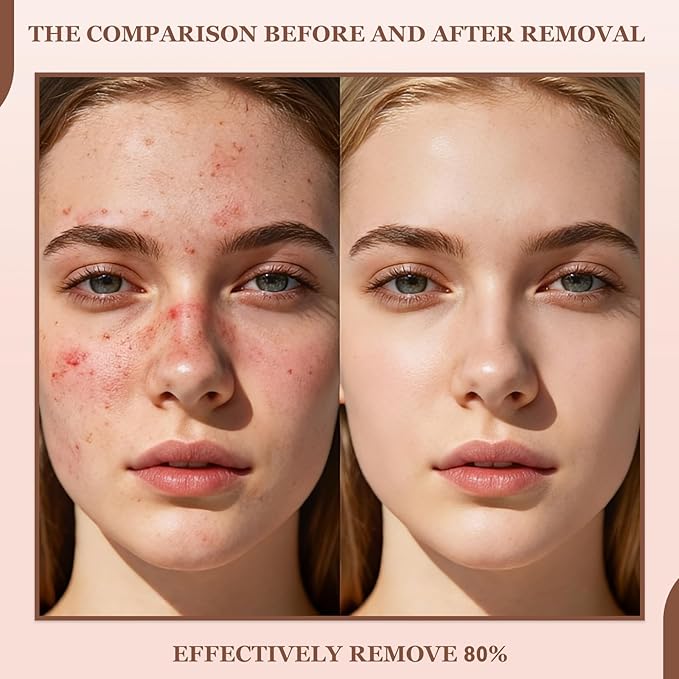 Rice Peel Shot Glow Rice Ampoule Duo | Pore Minimizing Gentle Peel & Deep Hydration |Black Rice Exfoliant for All Skin | 6.76 Fl Oz 2Pcs