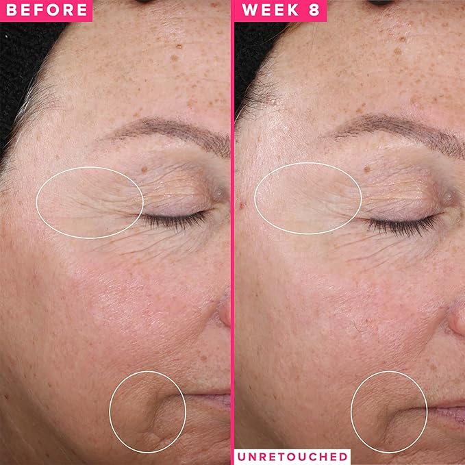 Farmacy Vitamin C & Retinol Serum Bundle - Waterless Vitamin C Face Serum & 1% Vitamin A Resurfacing Retinol Serum