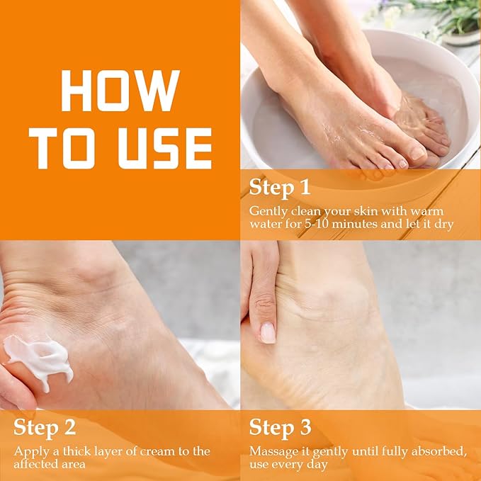 Fragrance Free 60% Urea Cream plus 2% Salicylic Acid, for Dry Cracked Hands Knees Feet Heels, Repair Unscented Foot Cream for Dead Skin, Lotion for Moisturizing and Softening 6.76 OZ