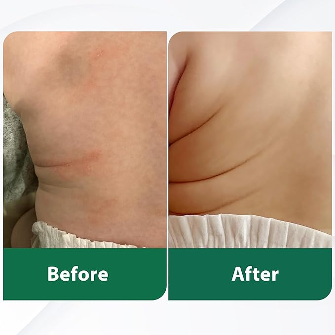 Grass Fed Whipped Beef Tallow for Skin with Manuka Honey - Silky Smooth, Fast Absorbing Tallow & Honey Balm - Ideal for Kids & Eczema Prone Area - Whipped Moisturizer for Dry & Sensitive Skin