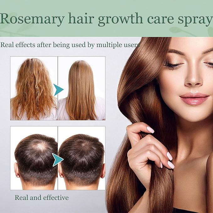 Natural Hair Growth Oil Spray:Rosemary Castor Batana Oil & Rice Water Lotion for Hair Growth ,Promotes Fuller Follicles for Women & Men – All Hair Type