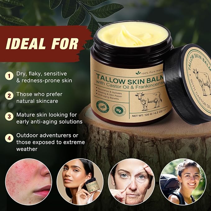 Beef Tallow Balm with Castor Oil & Frankincense – 100% Grass-Fed Beef Tallow Moisturizer for Face & Body Care – Nourishing Skin Balm to Repair Dry Skin, 4.2 oz