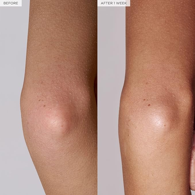 Glow Recipe Watermelon Glow Pink Dream Body Cream - Hyaluronic Acid for Skin Barrier Repair - Non Greasy Body Cream Brightening Moisturizer with Watermelon Seed Butter + AHA's (200ml)