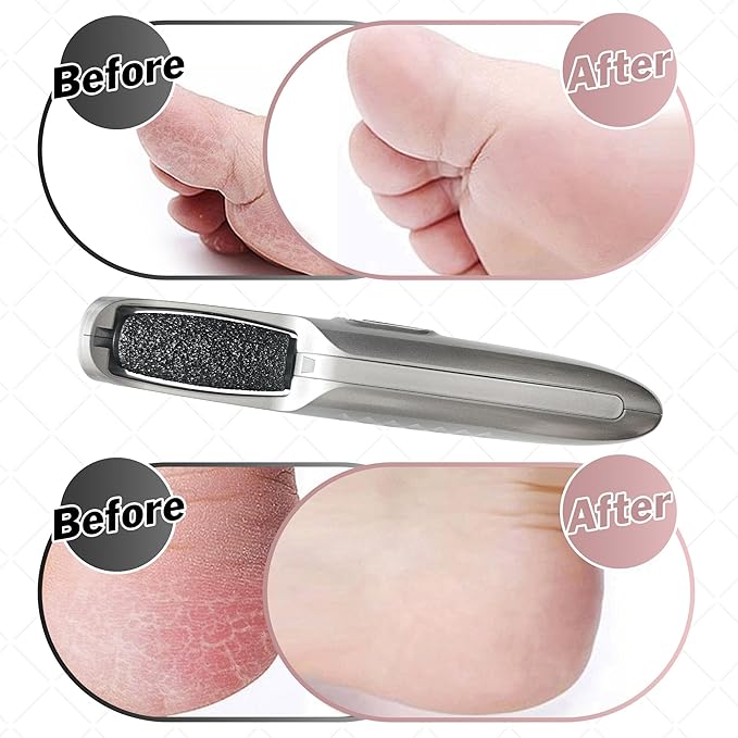 Powerful Electric Foot Callus Remover for Men - Rechargeable Pedicure Foot Grinder Files Away Dead, Hard Skin and Calluses on Heels for Smooth Soft Feet (Silver Grey)