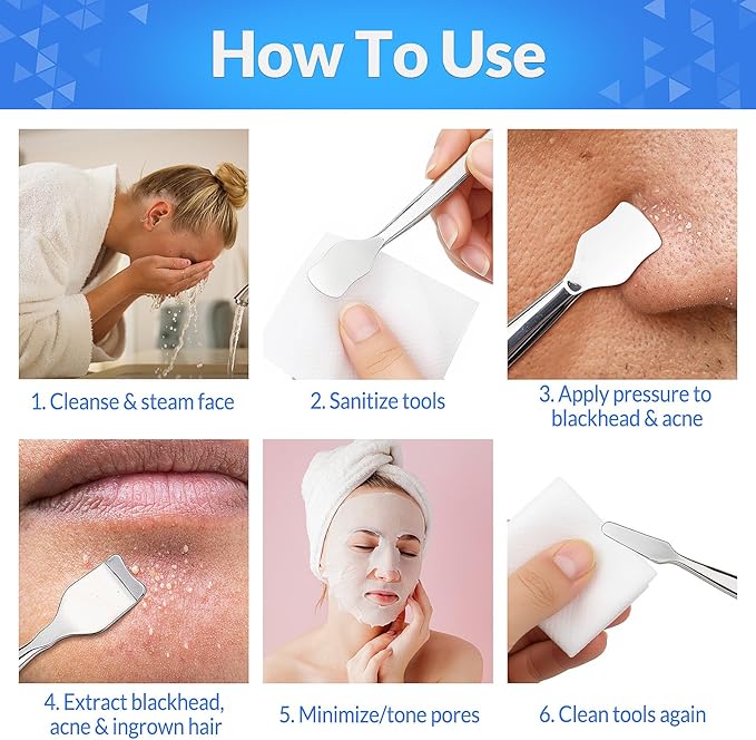 Blackhead Remover Pore Prep Tool Kit, 5PCS: 2× Blackhead Shovels, 2× Hair Tweezers, 1× 5X Mirror, Pimple Popper Tool, Stainless Pore Scraper, Comedone Extractor Tweezer Kit for Acne, Blemish (Black)
