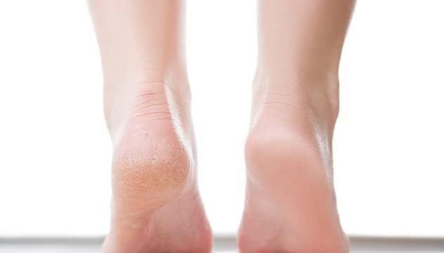 Ever Ready Corn & Callus Trimmer Refills x 4 - - Instant Relief from Corns | Removes Dry, Hard & Cracked Skin | Home Pedicure Treatment for Footcare