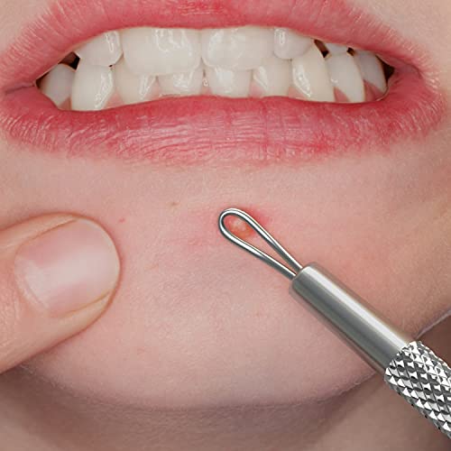 Suvorna White Head Remover for Face, Pimple Extractor, Pimple Popper, Whitehead Remover for Face, Comedone Extractor Tool, Pimple Extractor Tool, Pimple Popper Tool