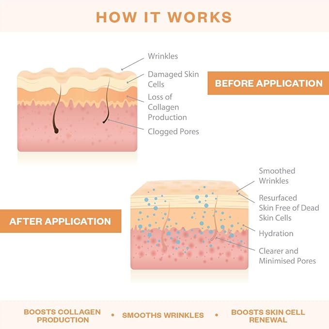 Wrinkles Schminkles Face, Neck & Décolletage Polishing Peel Pads, Skin Exfoliating & Resurfacing, Pack of 5 Towelettes