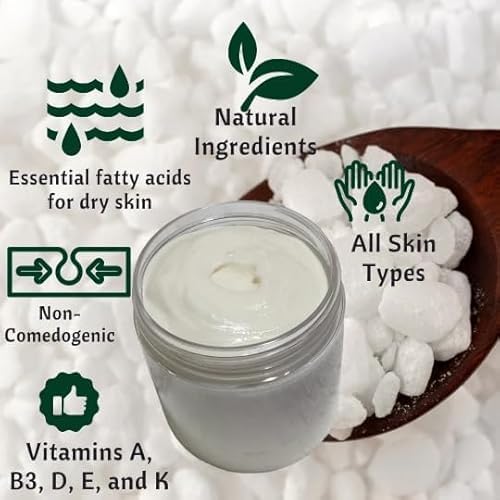 Grass-Fed Beef Tallow and Magnesium Body Butter, Natural Moisturizing Cream for Dry, Itchy, Cracked Skin, Handmade Diaper Rash (Sandalwood Vanilla)