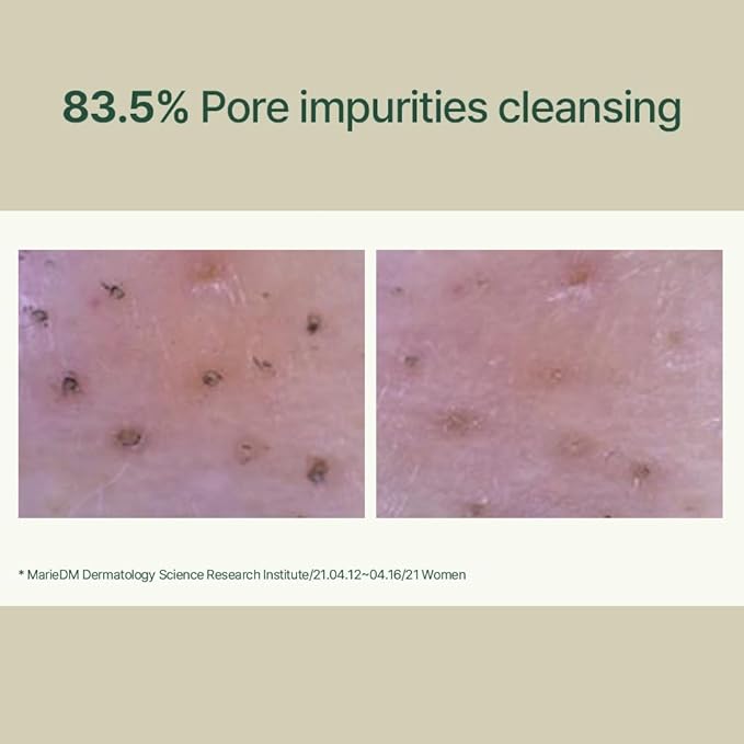 Pyunkang Yul PKY Calming Low pH Foaming Cleanser | Daily Face Wash & Makeup Remover with Tea Tree, Centella Asiatica, 5 Hyaluronic Acids that Removes Dead Skin Cells, Hydrates Skin - 150ml 5.07 Fl.Oz.