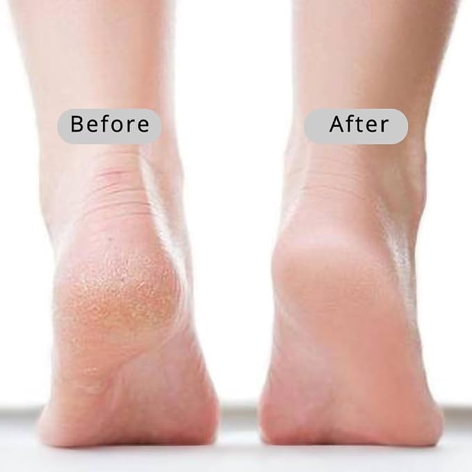 Extra Long Handle Pumice Stone for Feet - 13.7" No Bend Required Callus Remover Tool, Natural Volcanic Rock for Dry Cracked Heels & Dead Skin, Easy Grip for Seniors & Elderly (Curved)