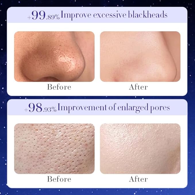 Blackhead Remover Mask, Collagen Peel Off Face Mask with Bamboo Charcoal, Oil Control, Deep Cleansing for Face & Nose Blackhead Removal Pore Cleaner for Men Women 3.5 oz