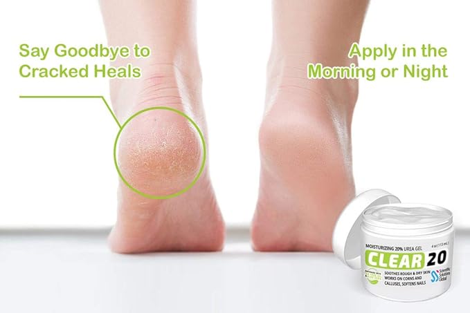 CLEAR 20, 20% Urea Gel, 4 oz w/ Tea Tree & Coconut Oil, Aloe Vera Extract, Callus & Corn Remover Moisturizes & Softens Cracked Heels, Feet, Elbows, Hands, Nails, Superior hydration to Urea Creams