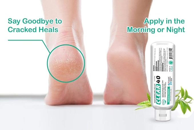 Clear 40, 40% Urea Gel, 8 oz w/Tea Tree & Coconut Oil, Aloe Vera Extract, Works on Calluses & Corns, Moisturizes & Softens Cracked Heels, Feet, Elbows, Hands, Nails, Superior Hydration to Urea Creams