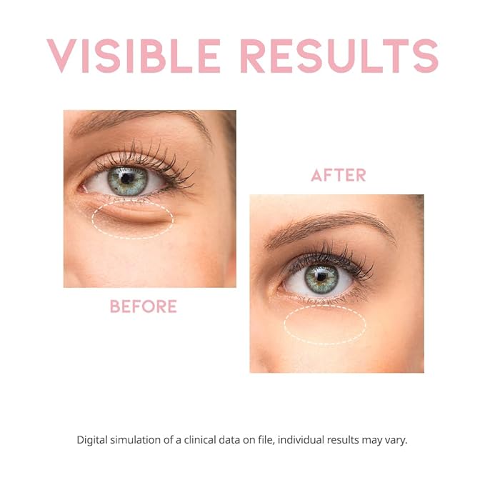 Caffeine Under Eye Cream Serum for Dark Circles, Puffiness and Eye Bags, Firming Treatment for Men & Women with Collagen & Vitamin E, Korean Vegan Facial Serum 30g