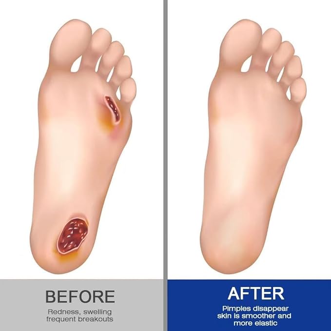 Sugar Guard Healing Foot Cream - Intensive Repair & Nourish For Soft, Healthy Feet Care