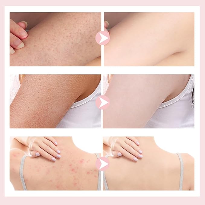 Super Soft Sunflower Suction Cup Bath Ball, 2025 New 2 in 1 Exfoliating Bath Sponge Cleaning Brush with Finger Rings, Sponge Mesh Pouf Shower Ball for Women & Men (Yellow 2pcs)