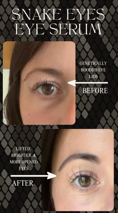 Intoxicated Cosmetics Snake Eyes Eye Serum 15 ml - Bakuchiol Under Eye Solution for Women and Men - Lift | Tighten | Brighten