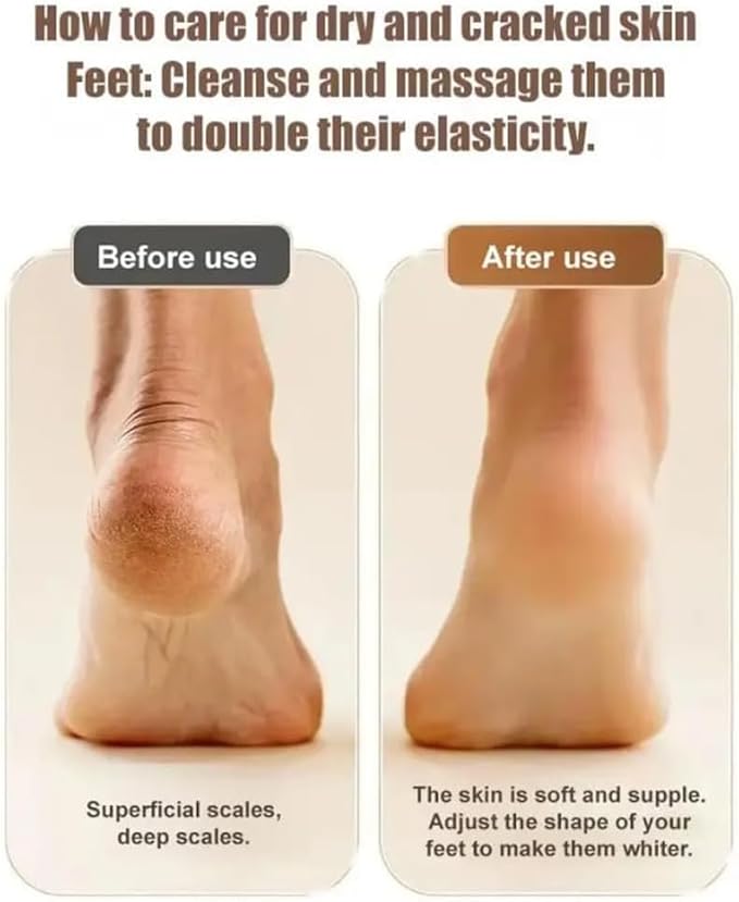 2025 New Electric Callus Remover for Feet, Portable Rechargeable Foot Repair and Grinding Device with Digital Display, Heel Polisher File for Men Women Dry Callus Dead Skin (Black)