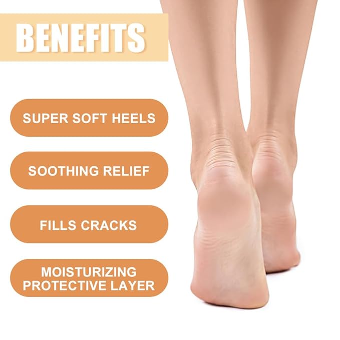 60% Urea Cream - 1.41 oz Manuka Honey Foot Hand Cream Stick for Dry & Cracked Feet Elbows Knees Heels Hands, Hydrates & Nourish Foot Care for Softening and Moisturizing, Removing Calloused Skin