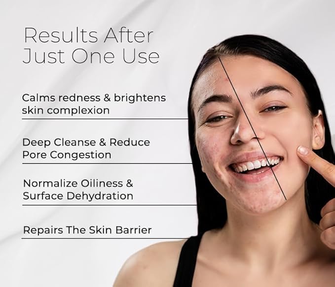 BIONOVA Bioactive Cleanser Oily Skin - Facial Cleanser Provides a Gentle Deep Clean, Oil-Free, Sulfate-Free, and Eliminates Excess Oil (4.5 fl oz)