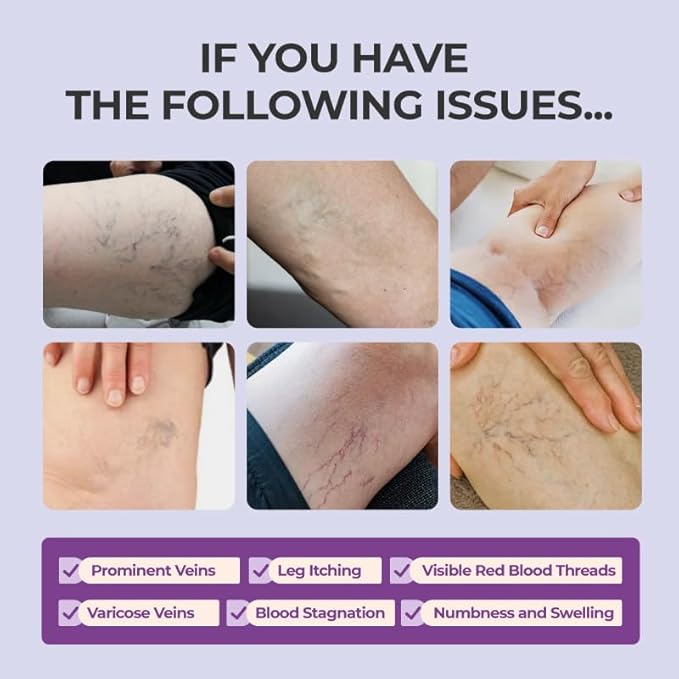 Soothing Leg Cream – Varicose & Spider Veins Relief, Cooling Gel for Leg Pressure & Discomfort, Natural Plant-Based Formula, 1.06 OZ, 3 Pack