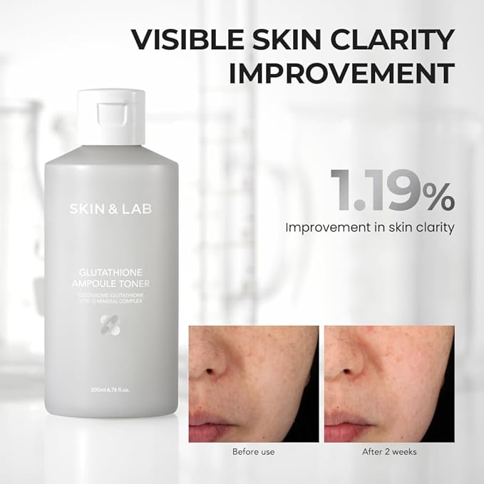 [Skin&LAB] Glutathione Ampoule Toner 6.76 fl oz, Improve Dart Spot, Hyperpigmented, Skin Clarity, Korean Toner for Sensitive Skin
