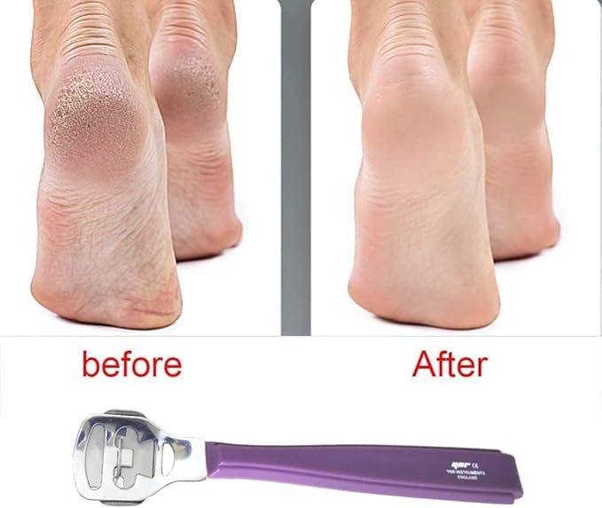 YNR Stainless Steel Calus, Remover for Feet, Foot Scraper & Callus Shaver, Calloused Feet Remover Tool with Callus Shaver Blades, Foot File for Calisis Removal