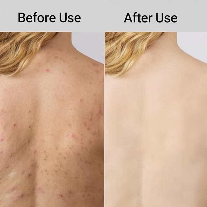 Blissal Exfoliating Shower Towel 47", Premium Scrub Wash Cloth for Body Face, Blissal Shower Towel for Smooth Skin, 2-in-1 Exfoliating Washcloth-Body Scrubber with 2 Sides for All Skin Types (Pink)