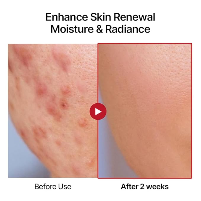 Swanicoco PDRN Hydrating Repair Ampoule Serum Powerful Anti Aging Face and Neck for Skin Turnover Skin Regeneration Wound Healing Korean Skincare, Christmas, Stocking Stuffer 30ml 1Fl Oz