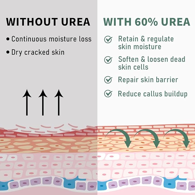 60% Urea Cream Maximum Strength, 10.1 oz - Foot & Hand Cream for Dry Cracked Skin, Callus Remover, with 2% Salicylic Acid - Deep Moisturizer for Cracked Heels, Rough Elbows & Knees - Fast Absorbing
