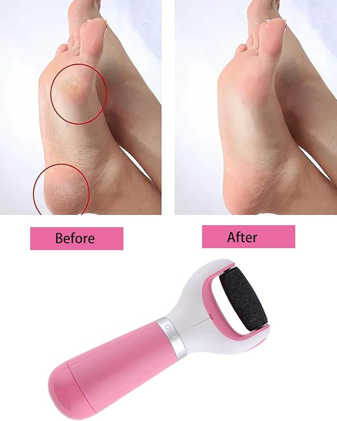 Electric Callus Remover for Feet Callus Remover Foot Callus Remover Tool Foot Buffer Electric Foot Calloused Feet Remover Tool Pedicure Supplies USB Charging and Battery Power＋1 Roller（Pink）