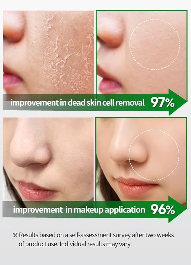 BEAUDIANI Green BHA Peeling Pad 60ct | Korean Exfoliating Toner Pads | Minimize Pores, Soothe Blemish-Prone Skin | Gentle Daily Chemical Exfoliant | K-Beauty Skincare