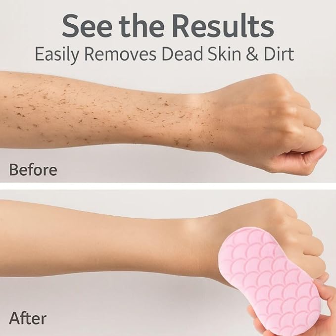 Magic Exfoliating Bath Sponge - 3D Exfoliating Bath Sponge for Dead Skin Removal, Skin-Friendly Exfoliator Also a Gentle Bath Sponge for Baby, for Adults, Kids & Pregnant Women (2Blue+2pink)