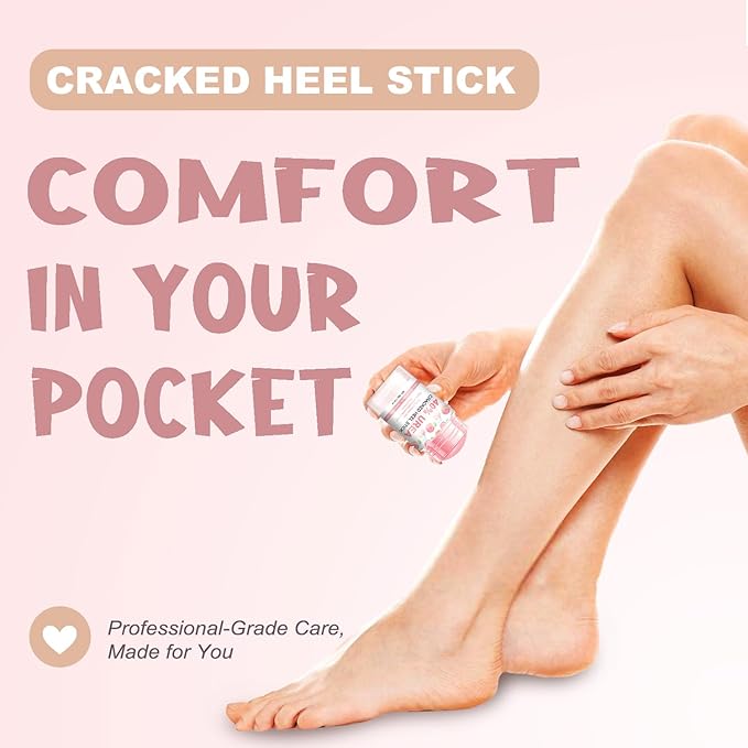 Urea Stick 40 Percent for Feet – Maximum Strength Heel Balm with 2% Salicylic Acid, Cracked Heel Treatment & Callus Remover, Hand & Foot Cream Enriched with Peach Extract & Avocado Oil – 1.41 oz