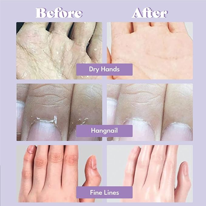 Catherine Muller Floral Hand Mask 8 Pairs, Moisturizing Gloves for Dry Hands with Elder Flower & CICA, Repairing and Nourishing Hand Care Treatment for Cracked, Rough, and Dry Skin, Stocking Stuffers